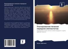 Bookcover of Планирование лечения передних имплантатов