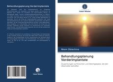 Bookcover of Behandlungsplanung Vorderimplantate