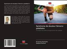 Buchcover von Syndrome de douleur fémoro-patellaire