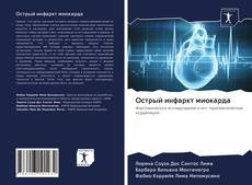 Oстрый инфаркт миокарда kitap kapağı