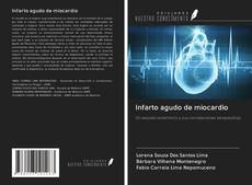 Infarto agudo de miocardio kitap kapağı