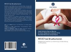 PET/CT bei Brusttumoren kitap kapağı