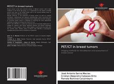 Capa do livro de PET/CT in breast tumors 