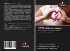 PET/CT nei tumori al seno的封面