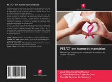 PET/CT em tumores mamários的封面