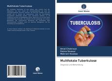 Bookcover of Multifokale Tuberkulose