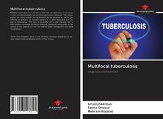 Обложка Multifocal tuberculosis