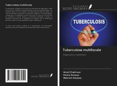 Tuberculose multifocale kitap kapağı