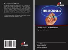 Bookcover of Tubercolosi multifocale