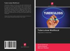 Capa do livro de Tuberculose Multifocal 