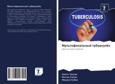 Bookcover of Мультифокальный туберкулёз