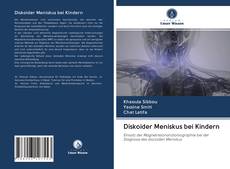 Bookcover of Diskoider Meniskus bei Kindern
