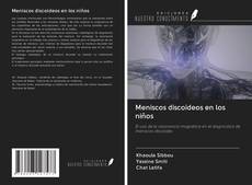 Bookcover of Meniscos discoideos en los niños