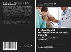 Buchcover von Evaluación del tratamiento de la fimosis del niño