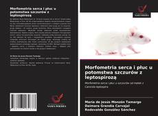 Capa do livro de Morfometria serca i płuc u potomstwa szczurów z leptospirozą 