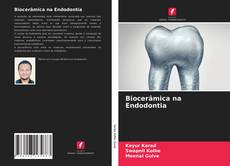 Bookcover of Biocerâmica na Endodontia