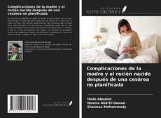 Bookcover of Complicaciones de la madre y el recién nacido después de una cesárea no planificada