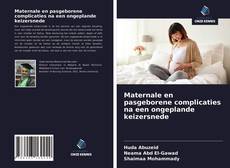 Bookcover of Maternale en pasgeborene complicaties na een ongeplande keizersnede