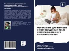 Buchcover von Осложнения для матерей и новорожденных после незапланированного кесарева сечения