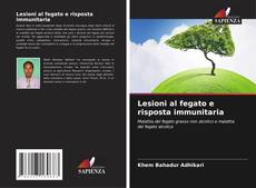 Bookcover of Lesioni al fegato e risposta immunitaria
