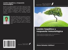 Borítókép a  Lesión hepática y respuesta inmunológica - hoz