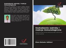 Buchcover von Uszkodzenie wątroby i reakcja immunologiczna