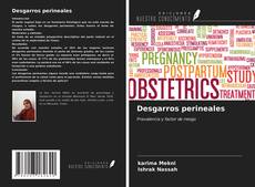 Bookcover of Desgarros perineales