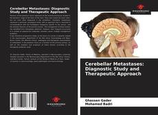 Cerebellar Metastases: Diagnostic Study and Therapeutic Approach的封面