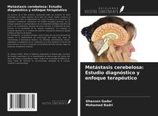 Portada del libro de Metástasis cerebelosa: Estudio diagnóstico y enfoque terapéutico