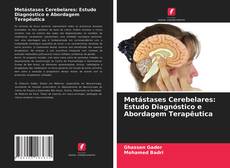 Bookcover of Metástases Cerebelares: Estudo Diagnóstico e Abordagem Terapêutica