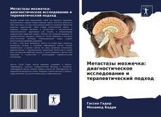 Capa do livro de Метастазы мозжечка: диагностическое исследование и терапевтический подход 