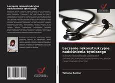 Bookcover of Leczenie rekonstrukcyjne nadciśnienia tętniczego