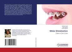 Buchcover von Molar Distalization
