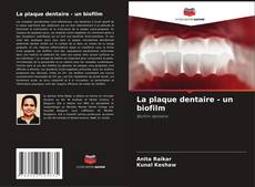 La plaque dentaire - un biofilm的封面
