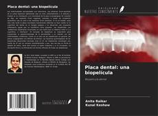 Copertina di Placa dental: una biopelícula