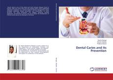 Buchcover von Dental Caries and Its Prevention