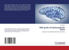 Buchcover von MRI guide of Hydrocephalic Brain