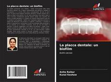 Обложка La placca dentale: un biofilm