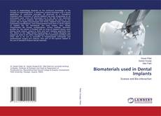 Copertina di Biomaterials used in Dental Implants