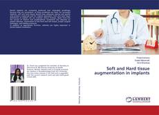 Copertina di Soft and Hard tissue augmentation in implants