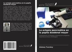 Bookcover of La ectopia pancreática en la papila duodenal mayor