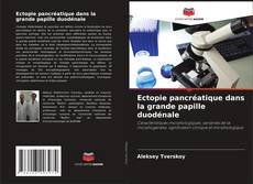 Buchcover von Ectopie pancréatique dans la grande papille duodénale