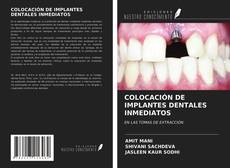 Bookcover of COLOCACIÓN DE IMPLANTES DENTALES INMEDIATOS