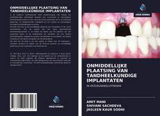 ONMIDDELLIJKE PLAATSING VAN TANDHEELKUNDIGE IMPLANTATEN的封面