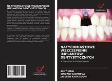 Copertina di NATYCHMIASTOWE WSZCZEPIENIE IMPLANTÓW DENTYSTYCZNYCH