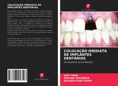 Borítókép a  COLOCAÇÃO IMEDIATA DE IMPLANTES DENTÁRIOS - hoz