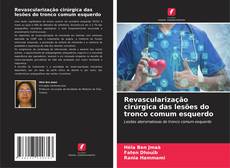 Buchcover von Revascularização cirúrgica das lesões do tronco comum esquerdo