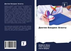 Bookcover of Дентин Бондинг Агенты