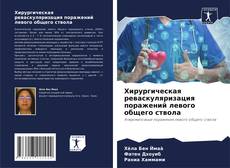 Couverture de Хирургическая реваскуляризация поражений левого общего ствола