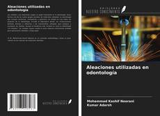 Bookcover of Aleaciones utilizadas en odontología